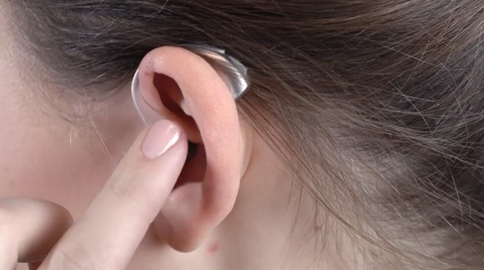 RIC R inserting the device